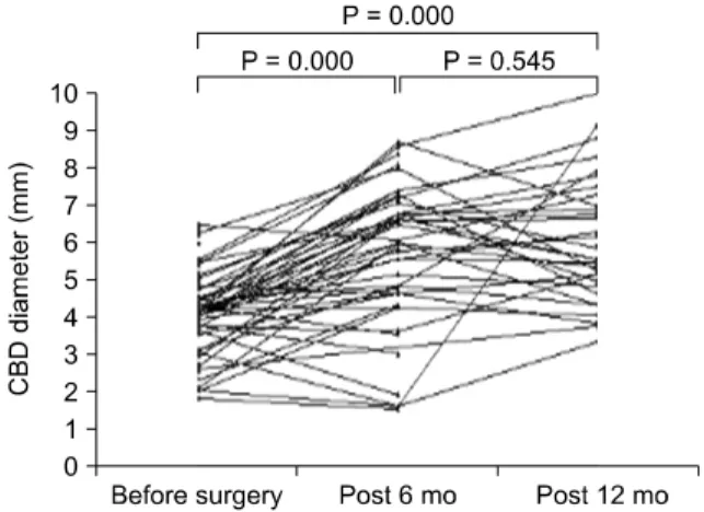 Fig. 1. Common bile duct (CBD) diameter increase 12 months after  surgery.