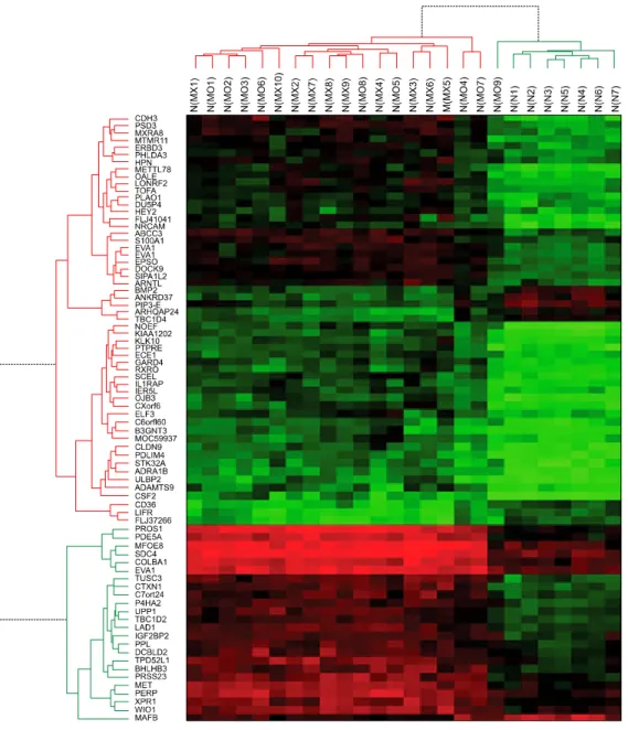 Fig. 2. Hierarchical cluster  analysis of genes associated  with papillary thyroid  carci-nomas (PTCs)