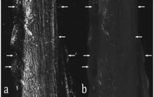 Fig.  1.  Maximum  Intensity  Projection  (MIP)  of  CRM  (a)  and  CLSM  (b)  micrographs