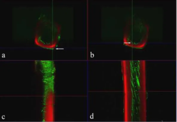 Fig.  3.  Grayscale  picture  of  Figure  2c.  The  upper part  of  the  fiber  showed  very  rough  surface (top  arrow),  but  the  lower  part  of  the  fiber showed  very  smooth  surface  compared  to  the  upper  part  (bottom  arrow).