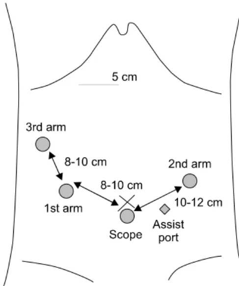Fig. 1. Computed tomography showing transposition of abdo- abdo-minal organs; there were no lymph node or distant metastasis in the 