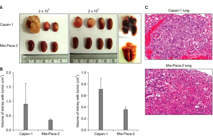 Fig. 4. Tumor formation ability of CD133＋ Capan-1 and CD133－ Mia-Paca-2 cells were compared after decreasing of number of injected cells.