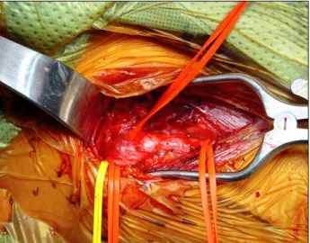 Fig. 7. Well defined nests of cuboidal cells (zellballen) are separated  by highly vascularizedfibrous septa (H&amp;E, ×400).