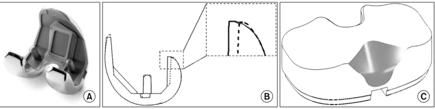 Fig. 1. NexGen CR-Flex Ⓡ  design features. (A) and (B) shows extended posterior condyle of the femoral component of NexGen CR-Flex Ⓡ  which increase the articular contact area at high flexion angle