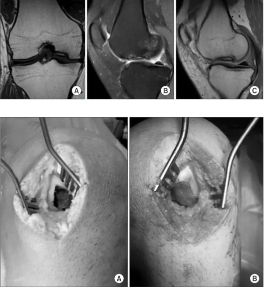 Fig. 1. Magnetic resonance imaging show­