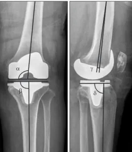 Fig. 2. Component positions according to the Knee Society radiological  evaluation method
