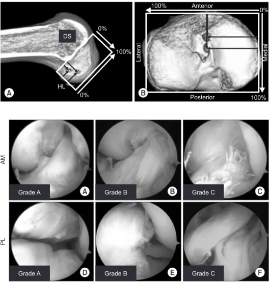 Fig. 2. Computed tomography image­based  measurement of insertion sites in the femur  and tibia