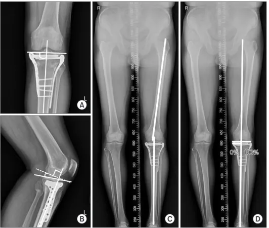 Fig. 3. Radiological evaluation. (A) The me­
