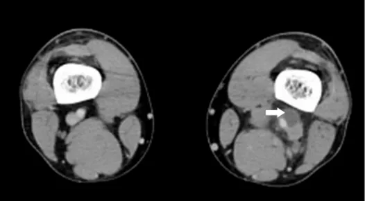 Fig. 1. Case 1: A 33­year­old man. Com­