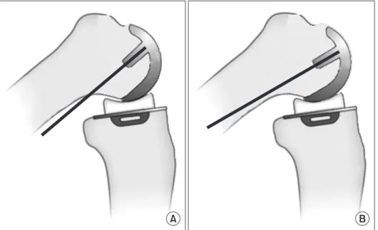 Fig. 1. Illustrations showing different sagit­