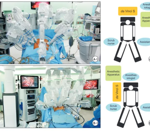 Fig. 3. Location of robot and operation  team: (A-1) da Vinci S located overhead  of patient, robotic arm for camera fixed  to body of robot; (A-2) anesthesiologist  steps aside from patient’s head; (B-1)  da  Vinci Xi located on right side of patient,  ro