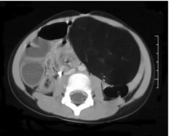 Fig.  4.  The  cut  section  of  the  specimen  shows  an  encapsulated  fat- fat-ty  mass  with  multilobuar  appearance.