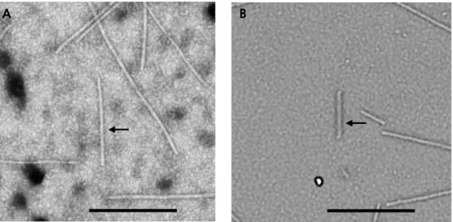 Fig. 3. Electron micrograph images of virus particles stained negatively (DN method) in leaf extracts of virus-infected  Phalaenopsis