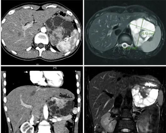 Fig. 1. Preoperative imaging studies. 