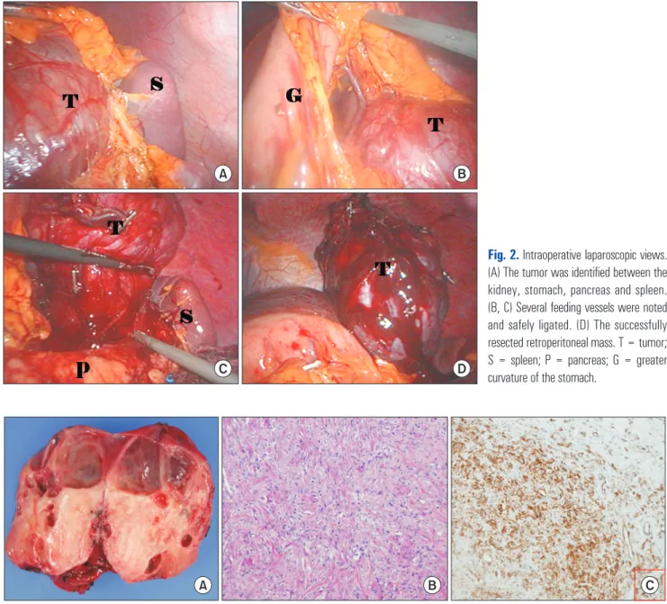 Fig. 2. Intraoperative laparoscopic views. 