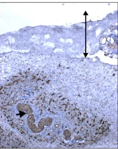 Table  2.  The  length  of  the  expression  of  CK15  in  regenerating  epithelium