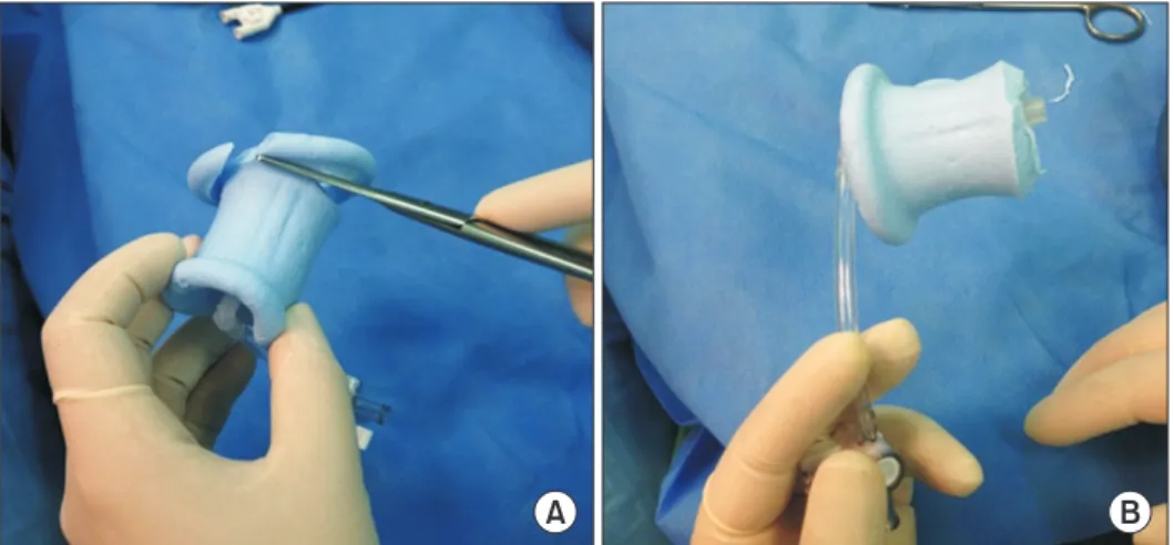 Fig. 4. SILS TM  port preparation for SUTI- SUTI-TEP. The bottom portion of SILS TM  port  was cutted.