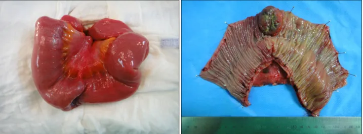 Fig.  3.  The  specimen  of  small  bowel  tumor.