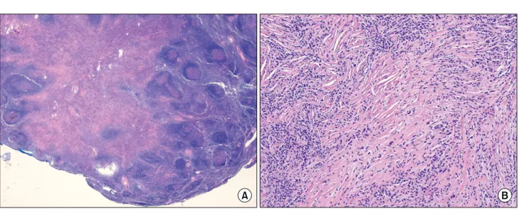 Fig. 5. Histopathologic finding. (A) This histopathologic features were consistent with lymph node (H&amp;E, ×10)