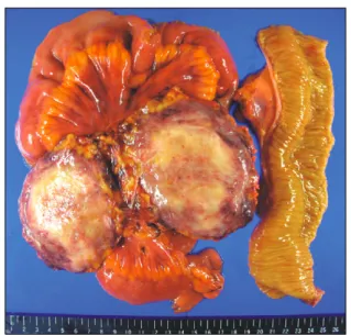 Fig. 3. Micro  pathologic  finding. 
