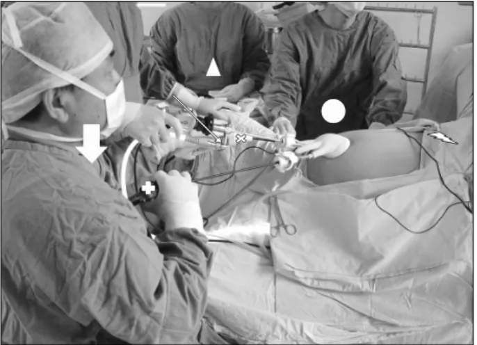 Fig.  1.  Thick  arrow  shows  the  operator  at  patient’s  left  side.  Thin  arrow  shows  the  camera  operator  between  the  patient  knees
