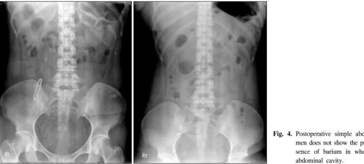 Fig.  4.  Postoperative  simple  abdo- abdo-men  does  not  show  the   pre-sence  of  barium  in  whole  abdominal  cavity
