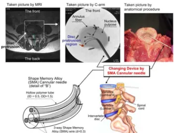 Fig. 1 Cadaver test using conventional straight cannular  needle, i.e., (a) C-arm system for spine surgery,  (b) Straight cannular needle injection into L4-L5
