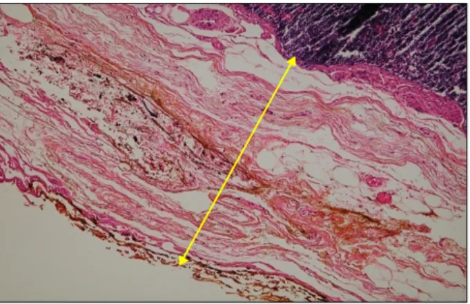 Fig.  1.  Specimen  after  application  of  dye.