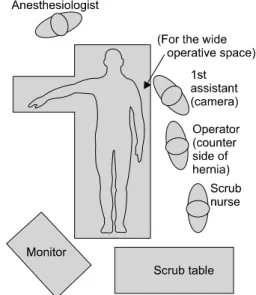 Fig.  1.  Operating  room  setup  for  right  inguinal  hernia.