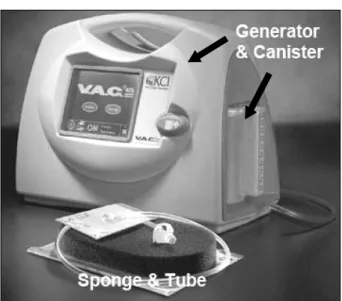 Fig.  3.  Components  of  VAC*.  Commercially  available  TNP  system  is  developed.  Vacuum  Assisted  Closure  system  (VAC Ⓡ ,  KCI,  San  Antonio,  TX,  USA).