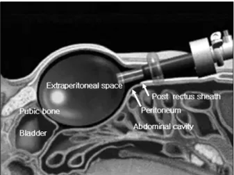 Fig.  2.  Location  of  the  trocars.