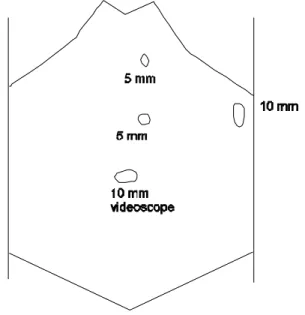 Fig.  4.  Prominant  basal  lamina  is  visible  (HE  stain,  ×100)  (A). 