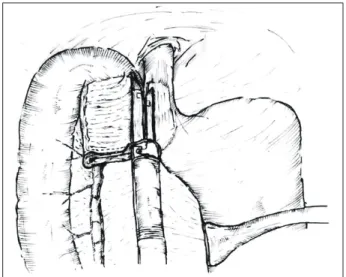 Fig.  3.  Upper  gastrointestinal  series  with  water  soluble  contrast  media. 