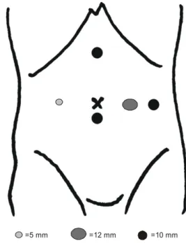 Fig.  2.  MRCP  shows  filling  defects  of  intrahepatic  duct  of  left 