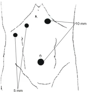 Fig. 2. Graham's patch closure &amp; modified Graham's patch  closure.