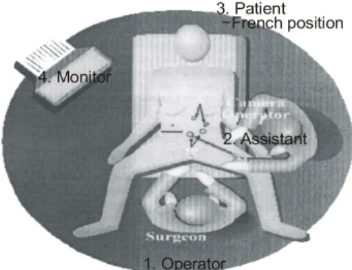 Fig. 1. Patient position for laparoscopic  gastrectomy.