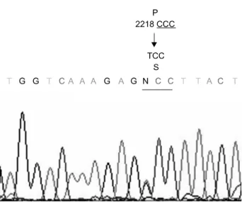 Fig.  2.  The  DNA  sequence  of  exon  14  PCR  product  of  CDH-1  gene  of  IPMN  patient  (F/68,  adenoma)  with  rectal  cancer