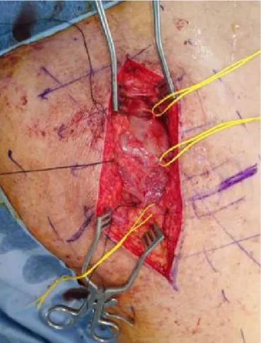 Fig. 1.  There was no specific finding except the scars at the left 