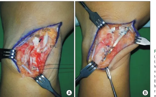 Fig.  4.  Intra-operative findings. 