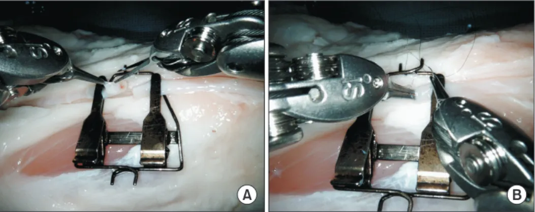 Fig.  4.  Robotic microsurgery. (A) Vessel preparation and skeletonization were successful with micro robotic instruments