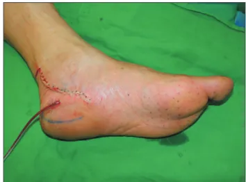 Fig. 4.  Excised ganglion cyst.  Fig. 5.  Postoperation.
