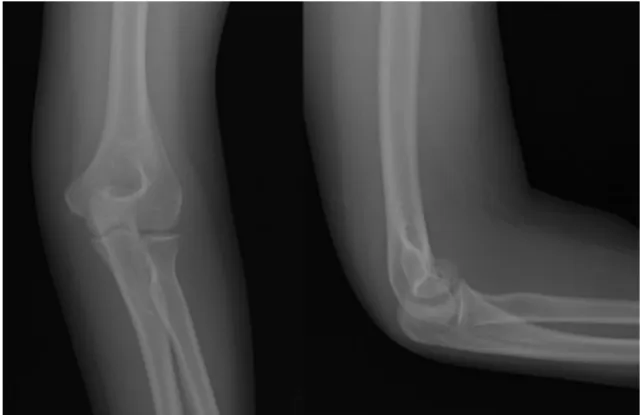 Fig. 2. (A, B) Initial computed tomography scan. 