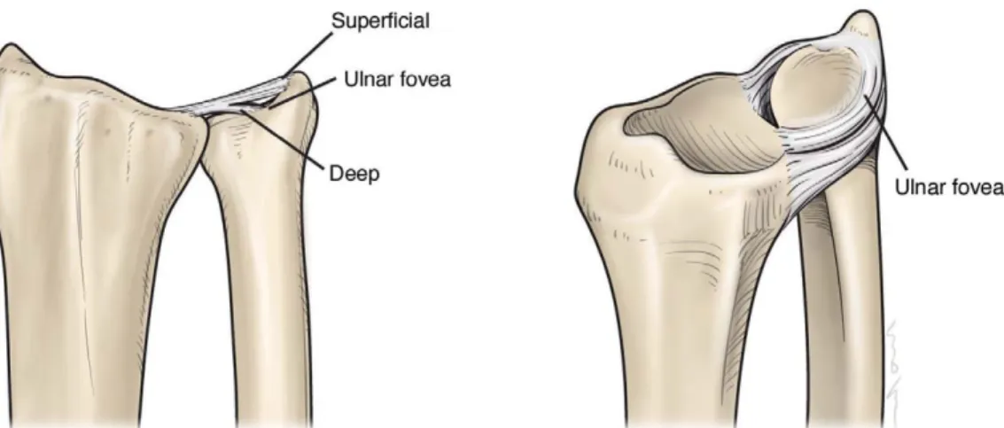 Fig. 1. Ulnar side insertion of the triangular firbrocartilage complex consists of deep and superficial fibers and when the tear involves the deep fibers, foveal insertion of the triangular fibrocartilage complex must be restored.