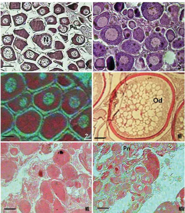 Fig. 6. Developmental stages of the ovary in Stephanolepis cirrhifer. A: Early growing stage (Dec.), B: Late growing stage (Apr.), C: Mature stage (Jun.), D: spawning stage (Aug.), E: Degenerative stage (Oct.), F: Resting stage (Nov.)