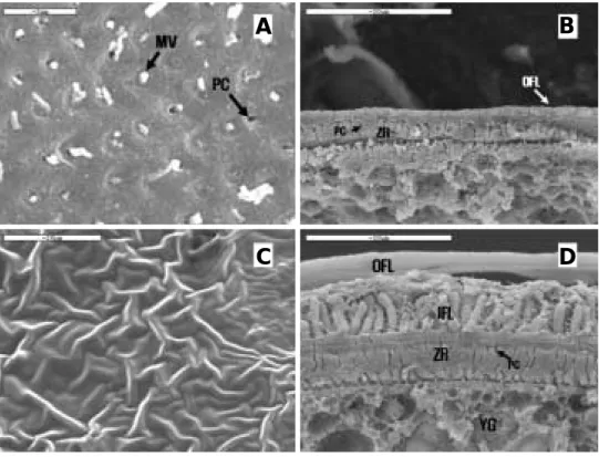 Fig. 4. Photographs of scanning electron micrograph on the oocyte surface of Rhynchocypris (Bar = = 20 µ m)