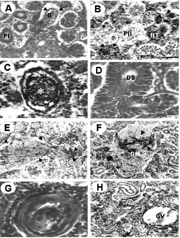 Fig. 3. The micrographs of the kidney of Carassius auratus in a sewage disposal plant