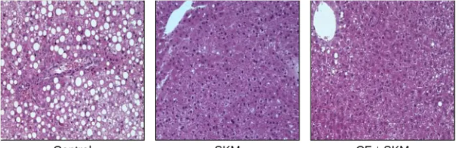 Fig.  2.  Effects  of  fermented  cucumber  bever- bever-age  on  hepatic  morphology  in  ethanol-treated  rats  ( × 200)