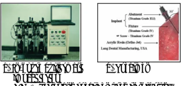 Table 1    Screw loosening torque with the same preload  due to types of implant system   