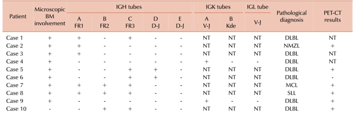 Table 2. Diagnosis of review panel samples showing clonal immunoglobulin gene rearrangements.