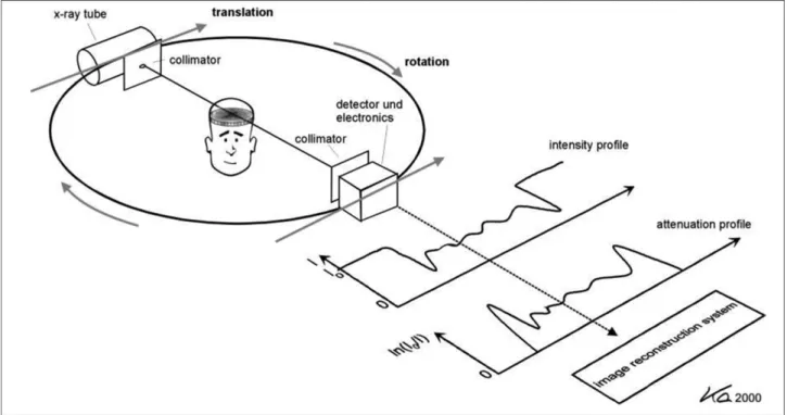 Fig. 6. Back projection. Back projection reconstructs an image by taking each view and smearing in along the path in was originally acquired [14].